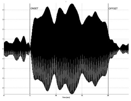 SSVEP narrowband brain response (14Hz)